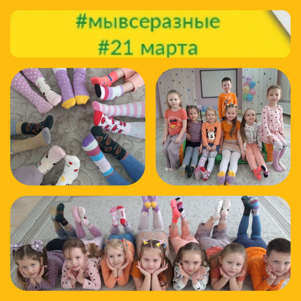 21 марта — Международный день человека с синдромом Дауна